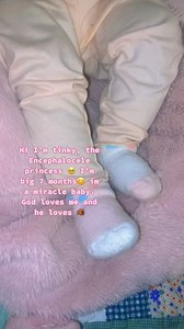 What is Encephalocele? : a rare birth defect in which the tissue covering the brain, and a portion of the brain itself, protrude through openings in the skull. - follow us to learn more🥹 #encephaloceleawareness #tinkywinky #tinky #fyp #foryoupage | Justice Kaur