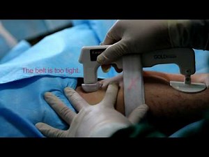 GoldFinger Femoral Hemostasis Compression Device