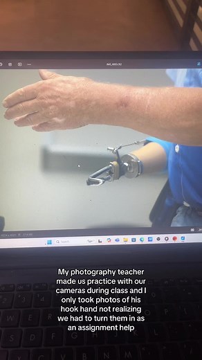 Using a Prosthetic Arm to Inspire Photography Assignments