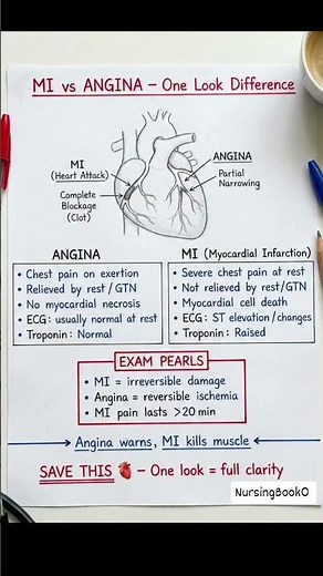 MI vs Angina in One Look | Heart Attack vs Angina | Quick Medical Comparison #heartattack #angina