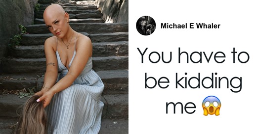“You Have To Be Kidding Me”: Makeup Artist With Alopecia Goes Viral With Stunning Transformations