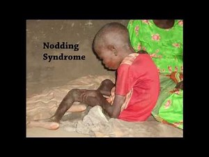 Nodding Syndrome