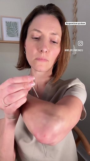 Acupuncture Needles Explained: A Close-Up Look