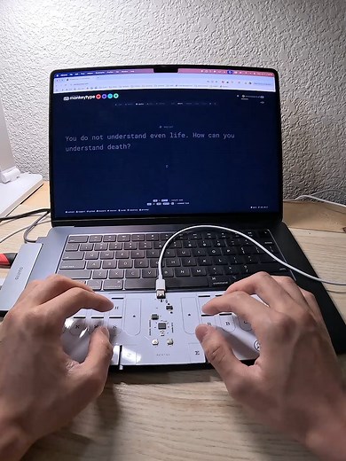Uso del Asterisco en Teclados y Accesorios