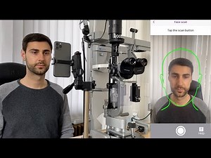 Smartphone Exophthalmometer
