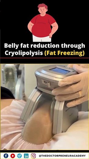 Cryolipolysis, also called CoolSculpting, is a non-surgical way to remove belly fat ❄️🔥.