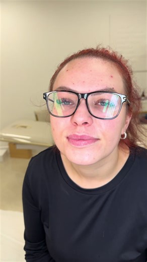 Lip Blush adding that extra wow to my clients lips #lipblushing #lipblush #bristol #aestheticvideos #transformation