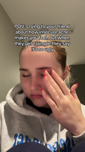 Acne Healing Guides: Understanding and Overcoming Insecurities