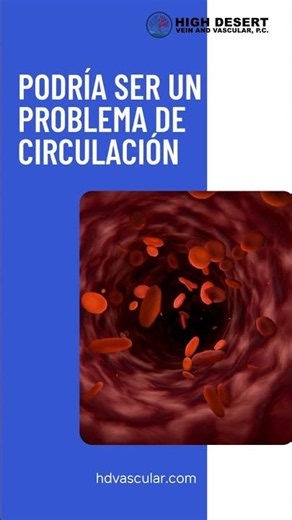 ¿Por qué sientes las piernas pesadas No es solo cansancio