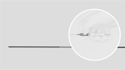 Rapid Medical™ überschreitet 1.000 Fälle mit DRIVEWIRE™ 24 in Nordamerika und expandiert mit MDR-Zulassung nach Europa