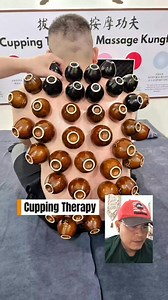 📌Cupping Therapy With Cup (Part-2) #cuppingtherapy #Cuppingmassage #Cupping #Massage | The Cracks