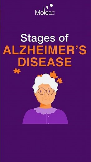 Stages of Alzheimer’s Disease