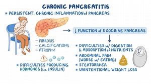 Video: Chronic pancreatitis: Clinical sciences - Video Explanation! | Osmosis | Osmosis