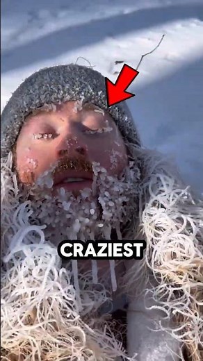 Snow Found Under the Microscope… This Is INSANE!😱