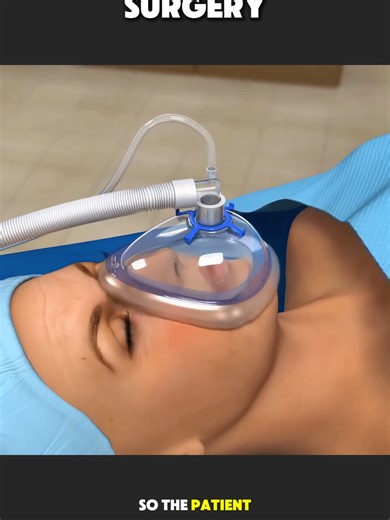 Jaw Contour Surgery (3D Animation) #jaw #contour #surgery #pain #3danimation
