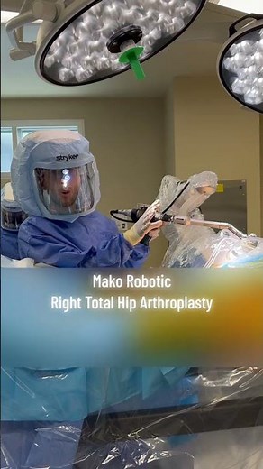 Robotic Right Total Hip Replacement 🔥🦿 | MAKO Precision by Dr. Dibra