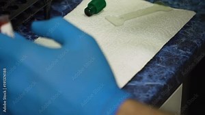 Slide peripheral blood smear method. Doctor examines and analyzes blood samples in the laboratory