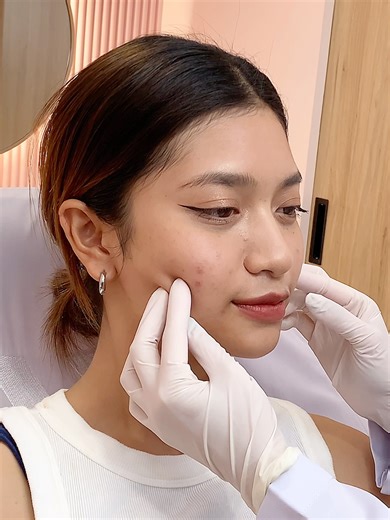 💎เก็บเหนียง ยกหน้าวี กระตุ้นคอลลาเจนผิวที่หย่อนคล้อย💎 แก้มตก เหนียงชัด หน้าหย่อนดูโทรม ไม่กระชับ จบปัญหาด้วย Program Full FaceLift ร้อยไหมยกทั่วหน้า เก็บเหนียง ยกแก้ม ยกกรอบหน้าให้ชัด กระตุ้นคอลลาเจนให้ผิวแน่นขึ้น หน้าเรียววี Program Full FaceLift ฉีดไหมยกกระชับ 🧚‍♀️ไหมด้ามชมพูยกกระชับผิวเหลว 🧚‍♀️กระตุ้นคอลลาเจนเติมผิวอิ่มฟู 🧚‍♀️ไหมเส้นเล็กฉีดได้ทั่วหน้า 🧚‍♀️ผิวกระจ่างใส รูขุมชนกระชับเรียบเนียน 🧚‍♀️ออกแบบการวางไหมตามปัญหาของแต่ละบุคคล เปิดให้บริการ 11.00 - 20.00 น. 👉 สาขาบางหว้า ( ติด BT