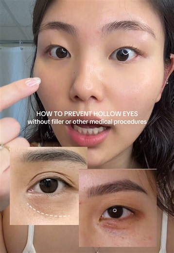 Skincare Tips for Preventing Hollow Under Eyes in Your 20s