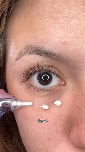 This eye cream with Retinol + NAD+ erased my dark circles ✨#shorts #numbuzin #eyecream #retinol #NAD