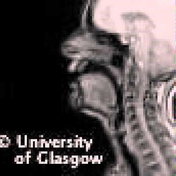 MRI voiced pharyngeal fricative