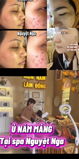 Video của SPA NGUYỆT NGA-LÂM ĐỒNG (@spa_nguyet_nga) với bản nhạc Đam mê của bạn là gì - LinhNoBi999 >