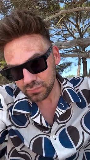 LAVIVID Hair System on Instagram: "Confidence Isn’t a Luxury. It’s a Necessity. You don’t just exist—you deserve to thrive. Stop settling for less than the best version of yourself. 🔥 Invest in you. The rest will follow. 🔥 Up to 50% OFF – Black Friday Starts Now! 👉 Start today: www.lavividhair.com #menshair #Lavivd #Lavividhair #mensstyle #menshairreplacement #menshairsystem #hairsystemformen #hairlossolutions #MensHair #HairLoss #HairRestoration #HairReplacement #HairTransformation #BeforeAn