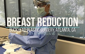 Breast Reduction Procedure and Results Video