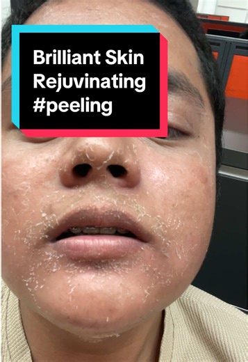 Brilliant Skin Rejuvenating Set: Visible Results in 48 Hours