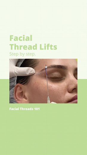 Is thread lifts painful?While some clients will experience a little...