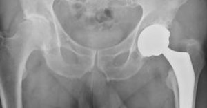 For medical tourists, it's simple math * WorldNetDaily * by Around the Web