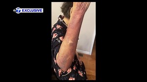 Exclusive: Elderly woman left black-and-blue in Queens jewelry store robbery; new video of suspects