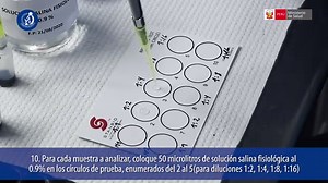 Prueba de rPR: Propósito, procedimiento y Resultados - Consejo del doctor 2026