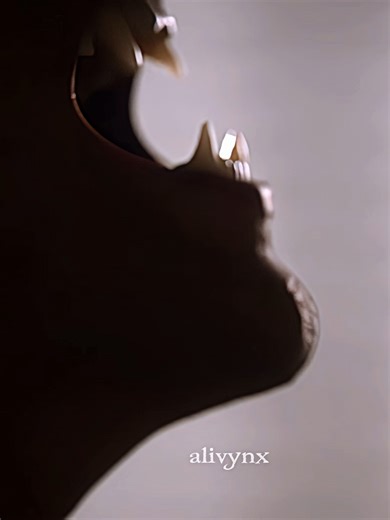 Scott McCall: The True Alpha in Teen Wolf