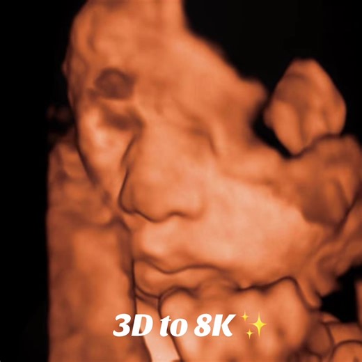 Ever seen your baby in 8K? At Sweet Pea 3D/4D Ultrasound, our advanced 8K imaging gives you crystal-clear details you can actually see and feel. Book your Sweet Pea experience today 💚 #8kimages #ultrasoundstudio #sweetpeaultrasound #nolamoms