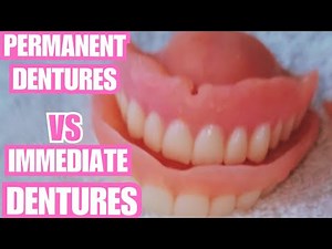 Permanent vs Immediate Dentures: Which Is Best For You?