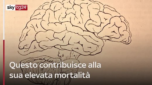 Ameba mangia-cervello: di cosa si tratta e dove si trova