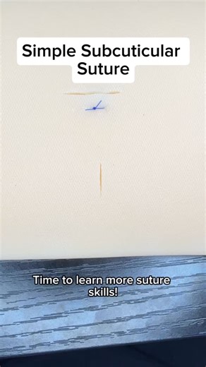 🪡 Suture Practice: Simple Subcuticular Suture • The simple subcuticular suture is one of the most common and versatile sutures used in all types of surgery and cosmetics. This suture allows for skin closures that are secure and don’t require follow up for removal. Usually done with dissolvable suture, simple subcuticular sutures are invisible from the surface and hold the wound closed until they are resorbed. #fyp #surgery #medicalstudent | Noah Sirkin