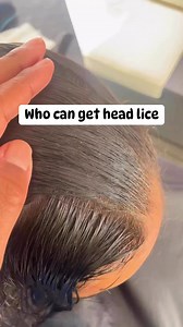 Who can get head lice? l full video on YouTube, link in bio #momlife #hair #school #piojos #explore | Stacey The Louse Lady