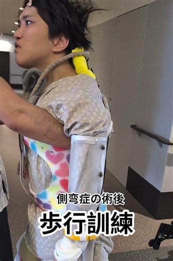 側弯症の術後２８日目 リハビリ #側弯症
