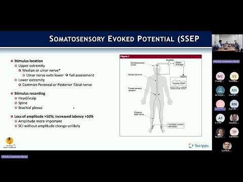 Intraoperative Neuromonitoring presented by Yusef Jordan, MD - February 17, 2025