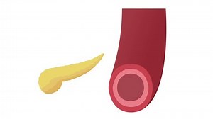 pancreas and insulin in blood graphic animation / description