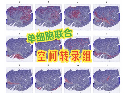 生信自学网-课程试学-单细胞联合空间转录组数据分析(Spatial transcriptome)
