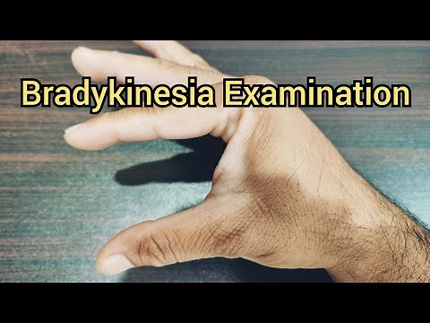 How to Examine a Patient for Bradykinesia? | Parkinsonism