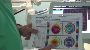 Custom Topography Tutorial for Refractive Cross Linking - Eyetube
