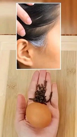 How can I stop GREY hair naturally? #greyhair | Natural Recipes