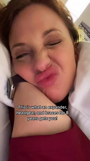 Embracing my Smile Transformation: Expander, Headgear, Braces Journey