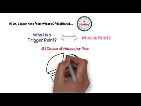 What is a trigger point - trigger points explained