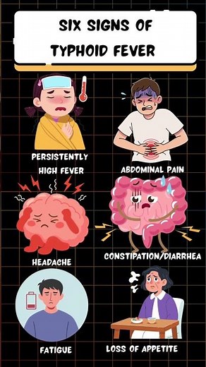 Typhoid fever - symptoms