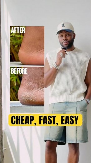 How I FIXED My CRUSTY Feet